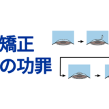 近視矯正手術の功罪