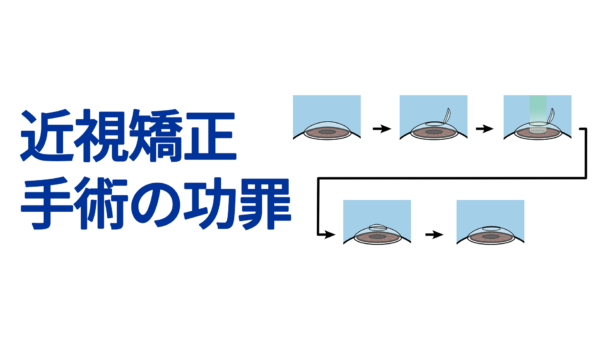 近視矯正手術の功罪
