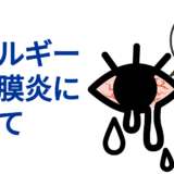 アレルギー性結膜炎について