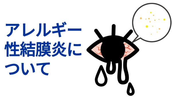 アレルギー性結膜炎について
